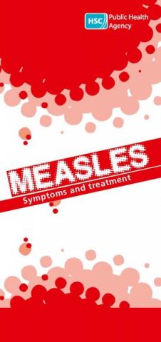 Measles: Symptoms and treatment