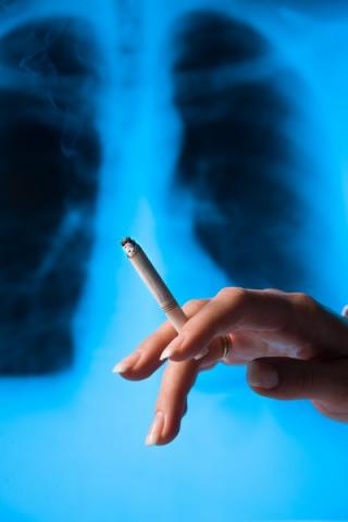 In Northern Ireland more than one in 10 cancers diagnosed are lung cancer, warns PHA In Northern Ireland more than one in 10 cancers diagnosed are lung cancer, warns PHA