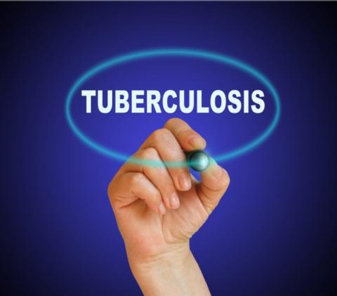 Early diagnosis crucial to tackling TB