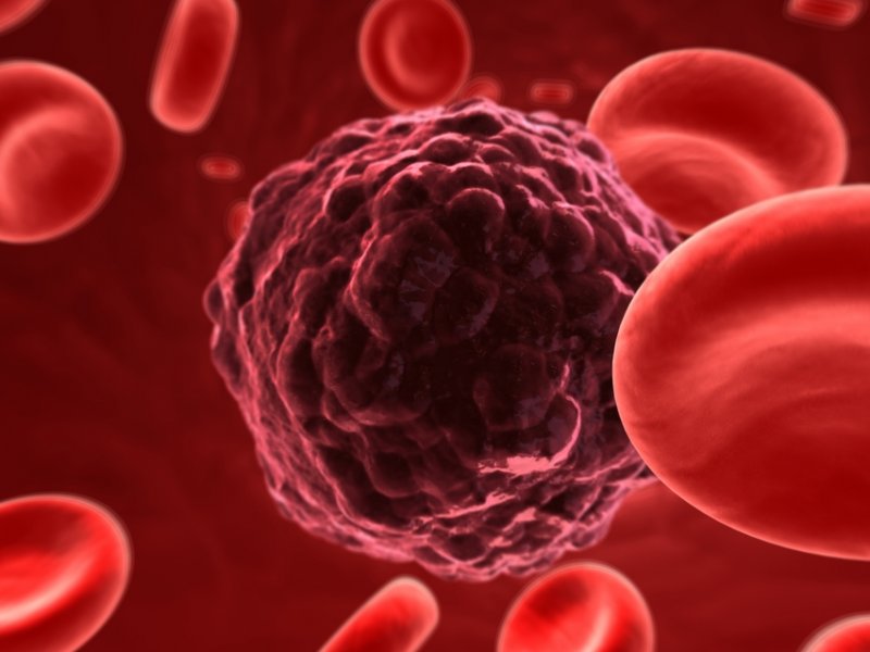 Women urged to be ovarian cancer aware