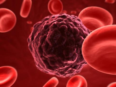 One third of cancers are preventable – reduce your risk now One third of cancers are preventable – reduce your risk now