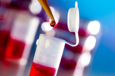 PHA reassures public that Ebola risk in Northern Ireland remains very low PHA reassures public that Ebola risk in Northern Ireland remains very low