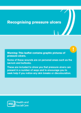 recognising pressure ulcers