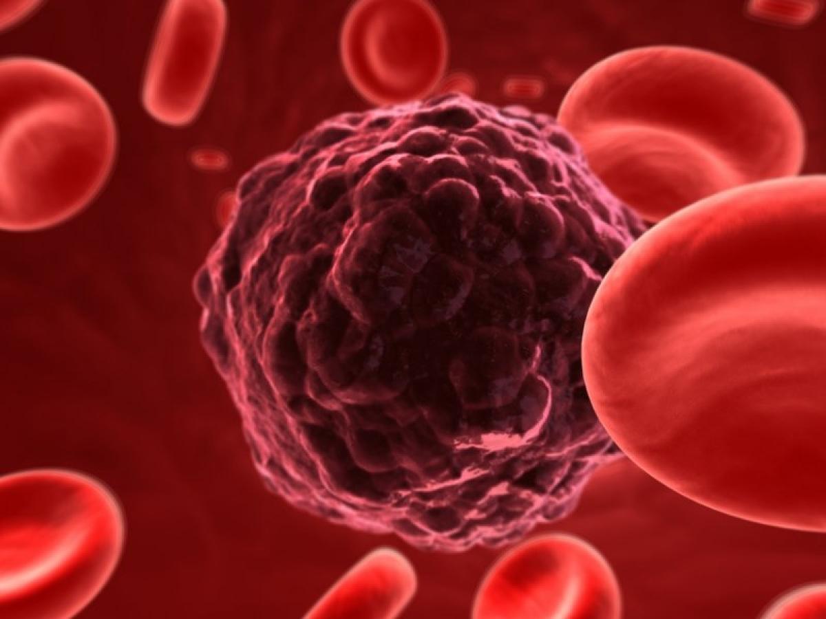 Women urged to be ovarian cancer aware